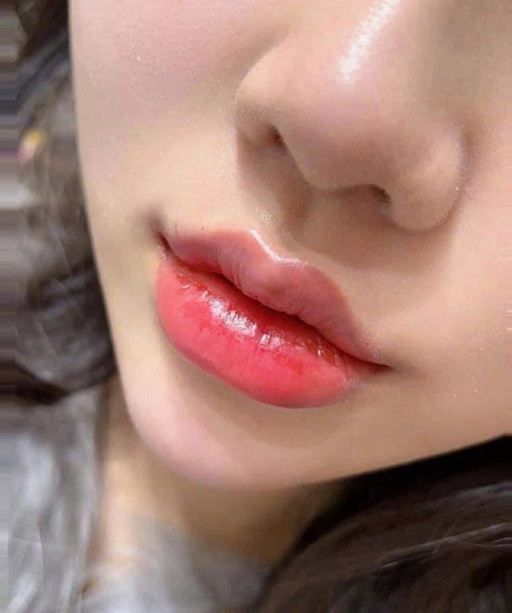 Phun Môi Collagen Tự Nhiên Tại Bình Dương